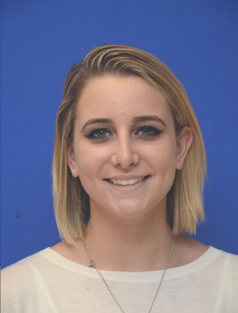 Rhinoplasty Before & After Gallery - Patient 321242 - Image 4