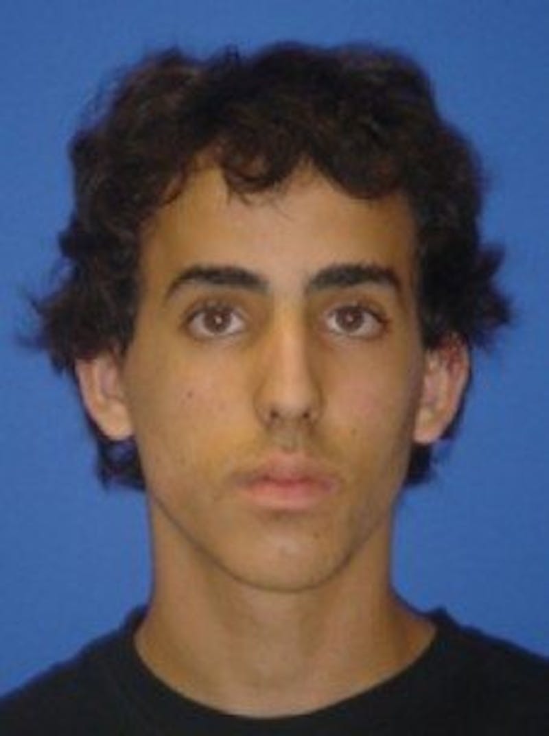 Rhinoplasty Before & After Gallery - Patient 942697 - Image 3