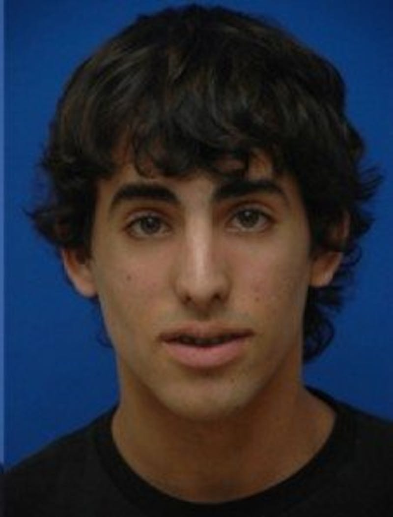 Rhinoplasty Before & After Gallery - Patient 942697 - Image 4