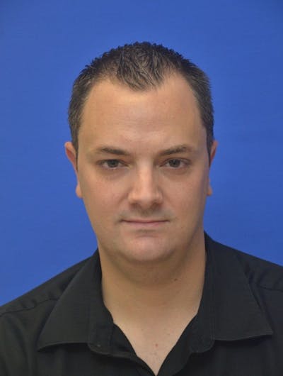 Ear Pinning Surgery Before & After Gallery - Patient 214177 - Image 2