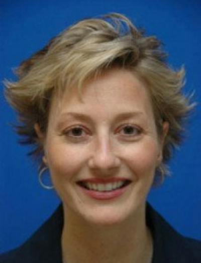 Ear Pinning Surgery Before & After Gallery - Patient 175852 - Image 2