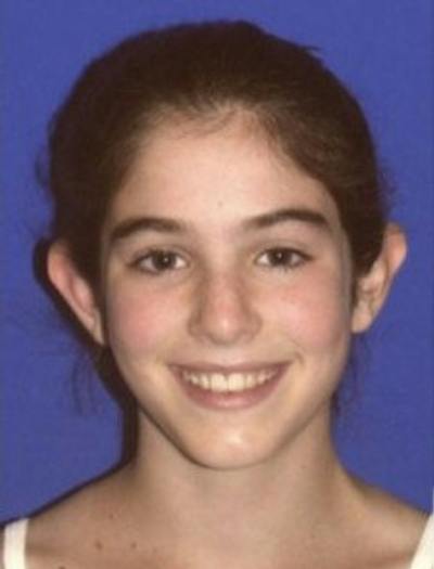 Ear Pinning Surgery Before & After Gallery - Patient 329188 - Image 1