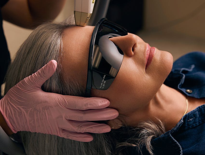 woman getting laser treatment on her face