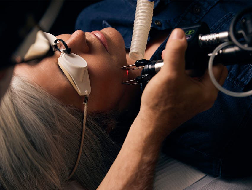 woman getting laser treatment on her face