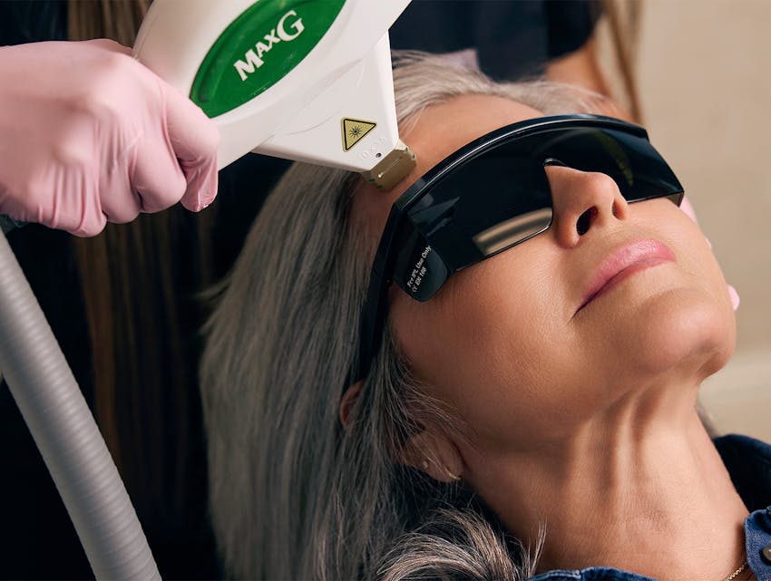 woman getting laser treatment on her face