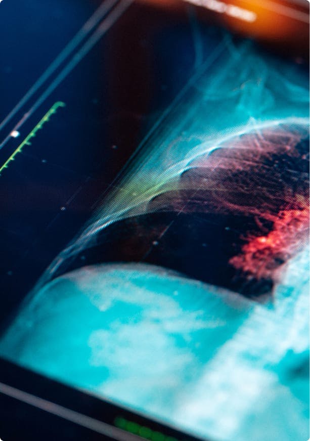 xray
