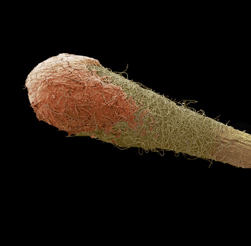 Cerumenograma