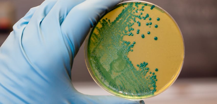 Listeria - a bacteria that can cause a rare infection.