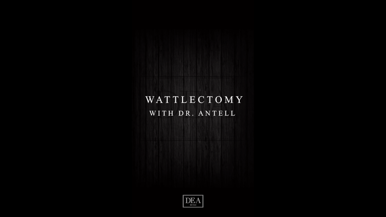 Wattlectomy thumbnail
