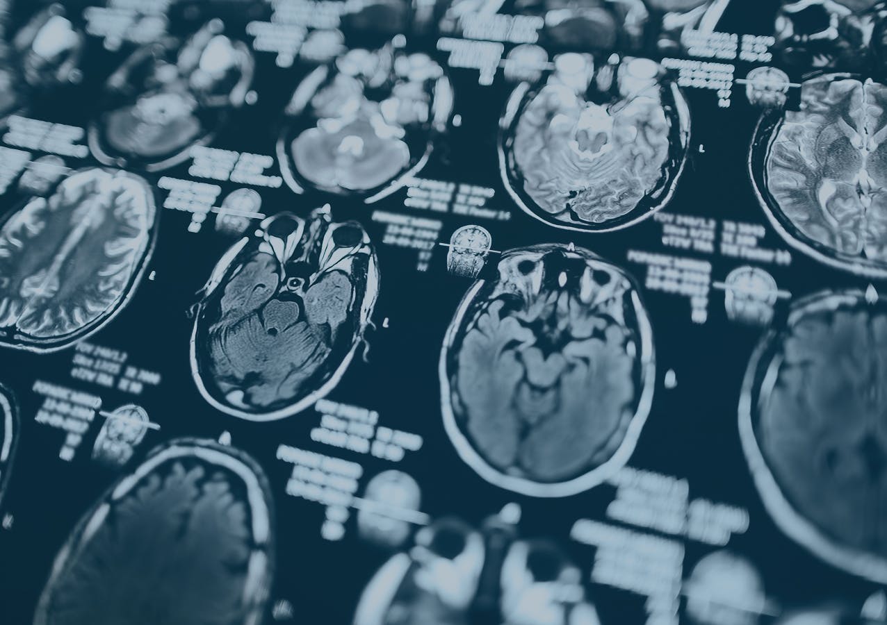 brain scans