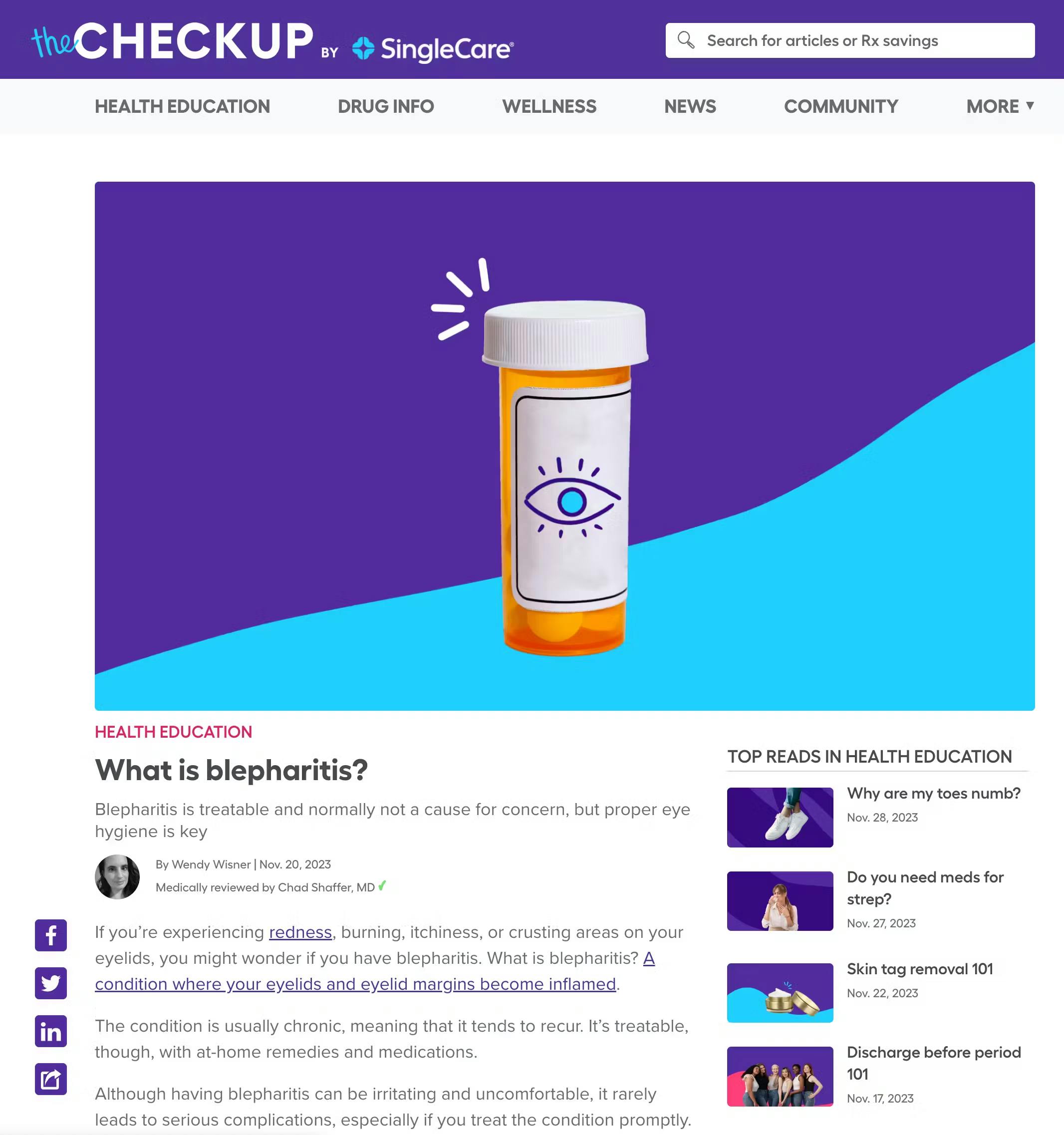 SingleCare.com featured Dr. Giyaur's commentary in their story, What is blepharitis? on their blog, TheCheckup.
