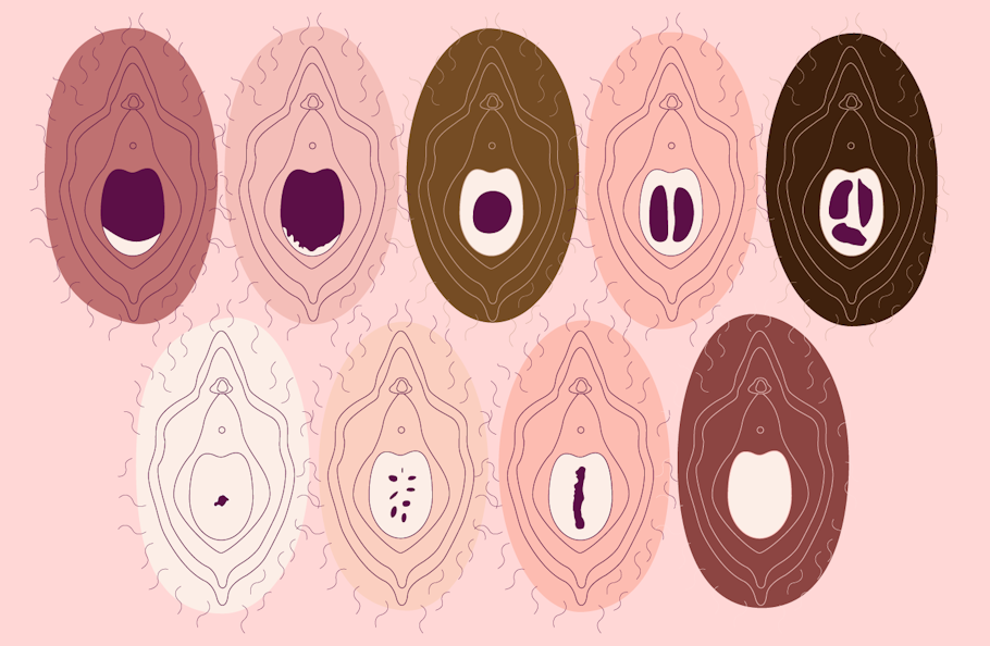 image of 10 vulvas each showing a hymen in different state