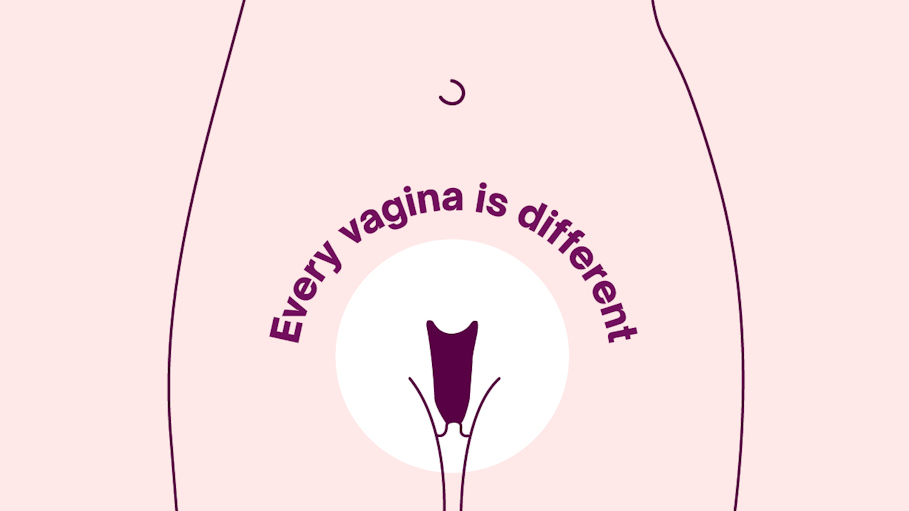 Illustration of vagina with text reading 'every vagina ius different'