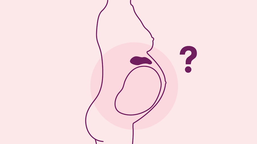 Silhoutte of pregnant woman with highlighted stomach and hanging questionmark 