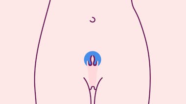 Illustrated outline of a female torso showing the vagina and cervix highlighted