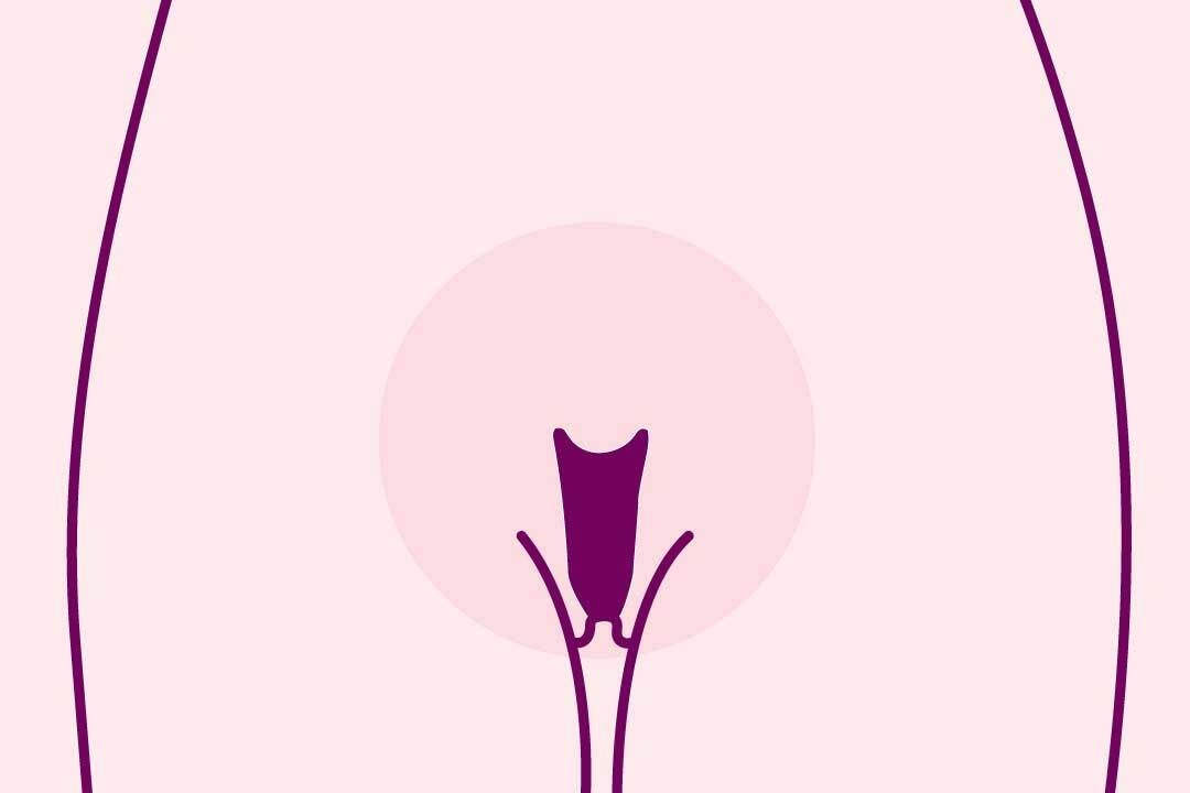 What Causes Vaginal Dryness? | Dry Vagina | Natural Cycles What Causes Vaginal Dryness? | Dry Vagina | Natural Cycles