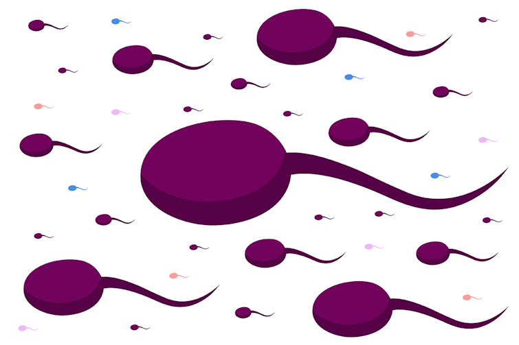 Illustration of many sperm cells swimming