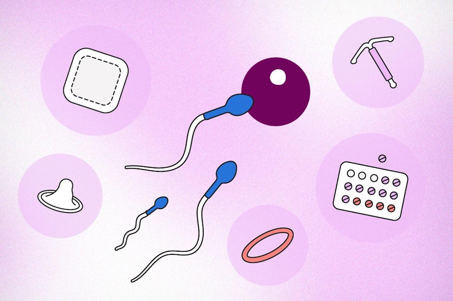 Illustration of sperm cells travelling toward egg cell surrounded by various birth control methods such as the pill, IUD and condom
