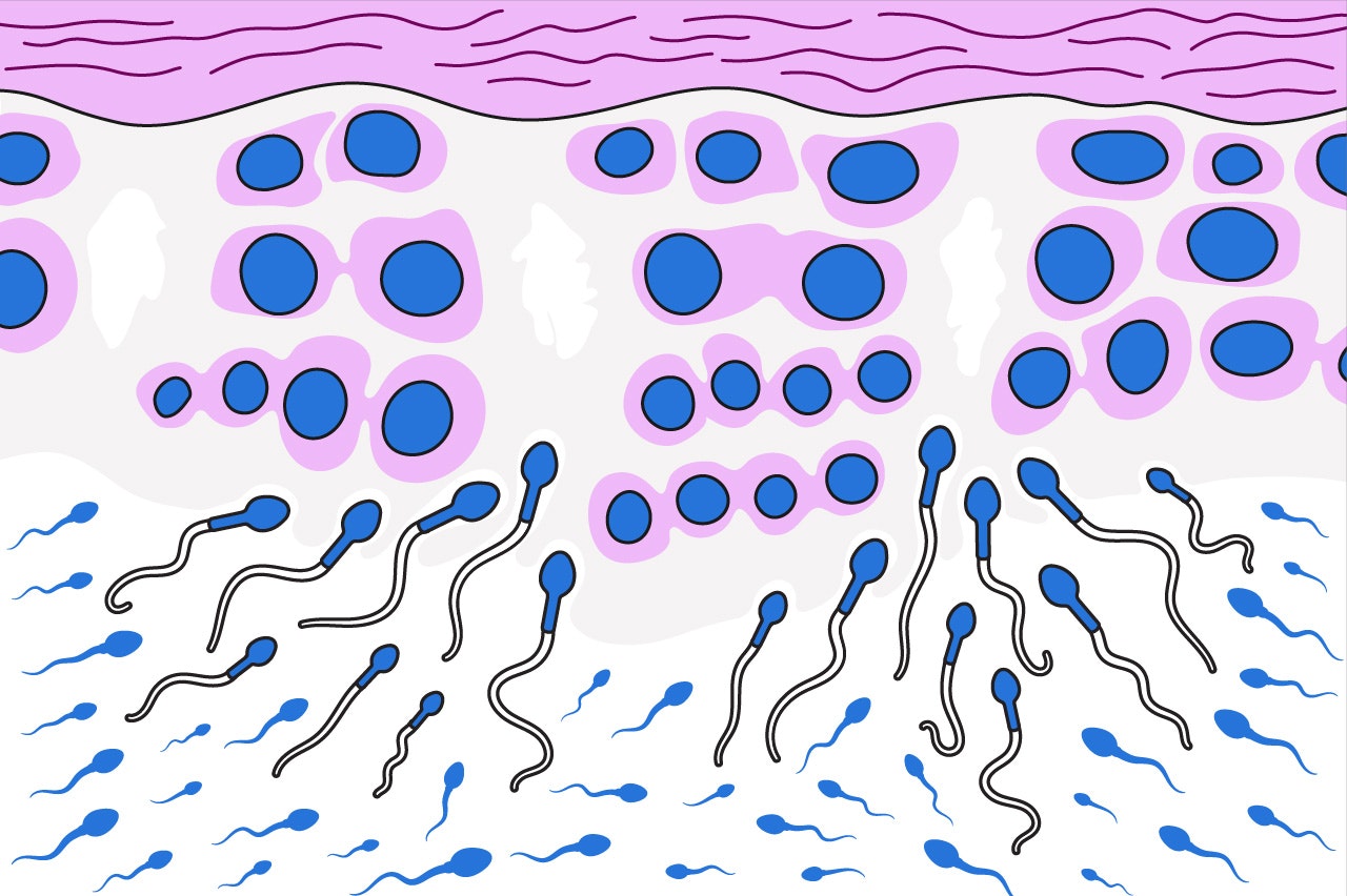 Illustration of sperm production in the testicles