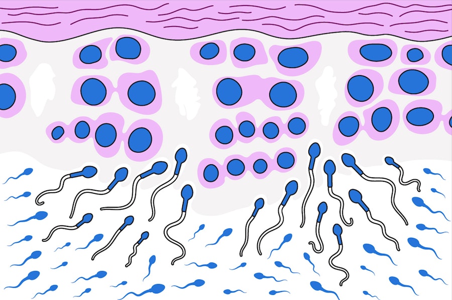 Illustration of sperm production in the testicles