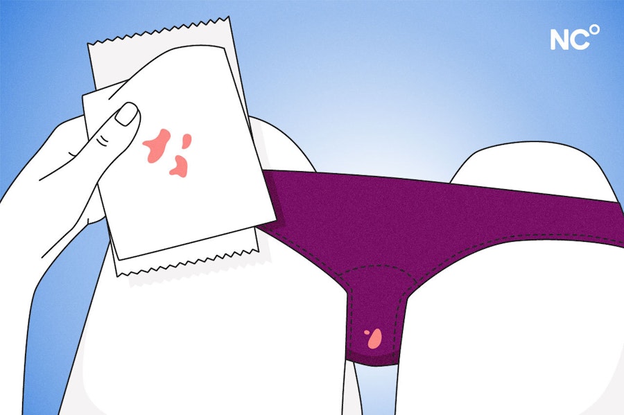 Illustration of underwear showing spotting
