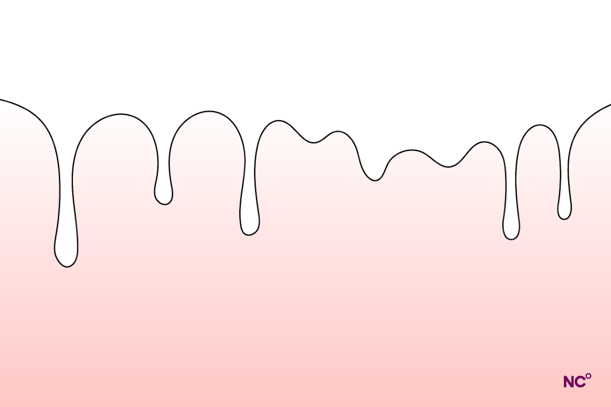 Vaginal Wetness: Types, Causes, and What is Arousal Fluid Vaginal Wetness: Types, Causes, and What is Arousal Fluid