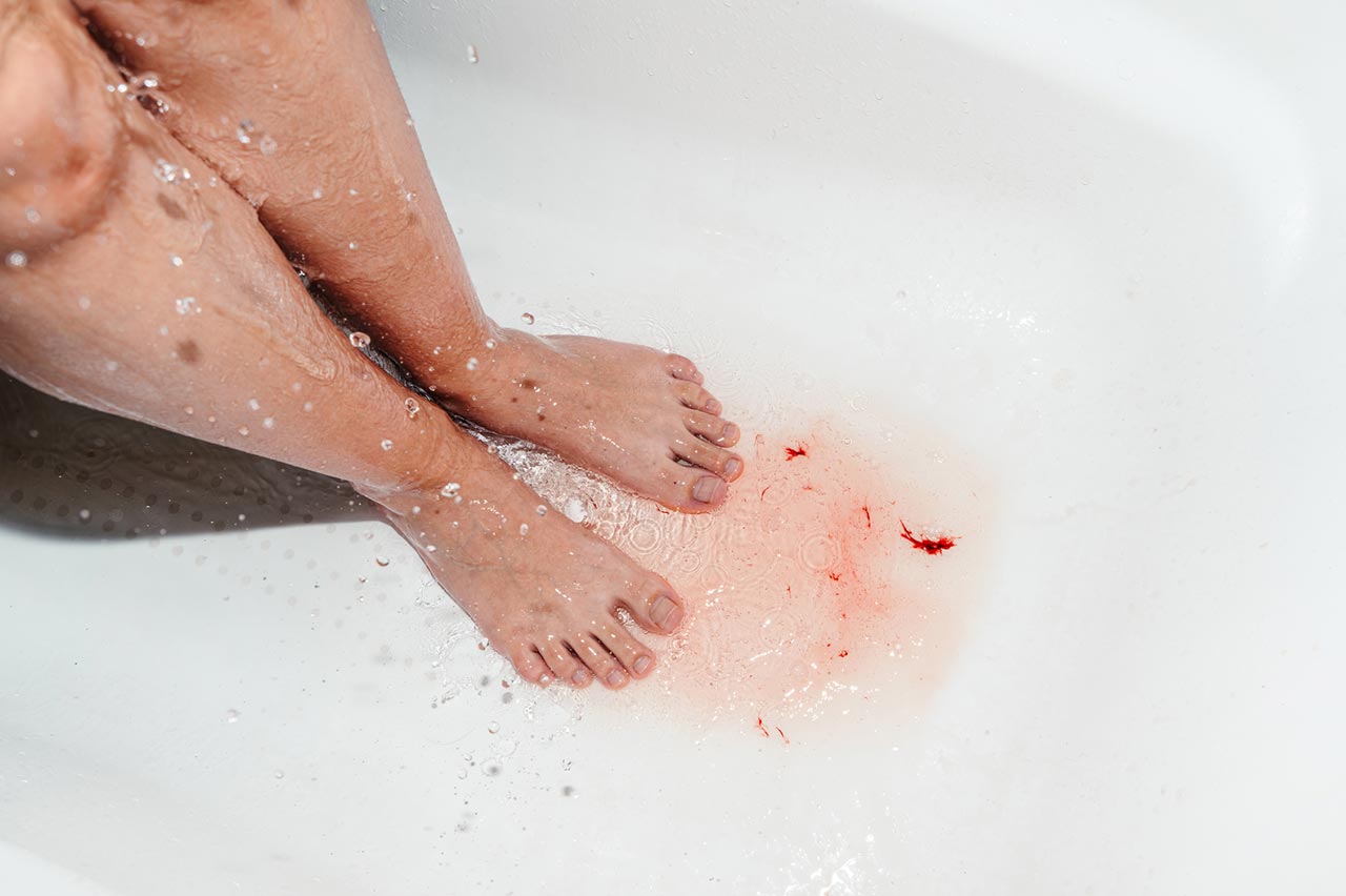 Period Blood Clots (Image): What Are They, Causes, & Are They Normal