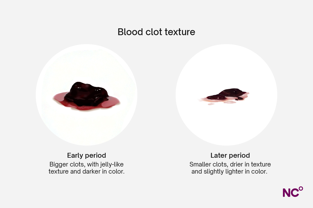 https://www.datocms-assets.com/21281/1733317166-blood-clots_infographic_texture_0212.jpg?utm_source=chatgpt.com