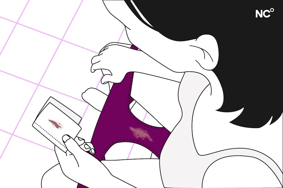 flujo vaginal