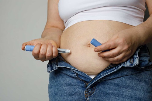 Photo of a woman injecting weight-loss medication into her belly