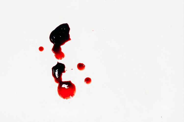 Small amount of blood spattered on a white background