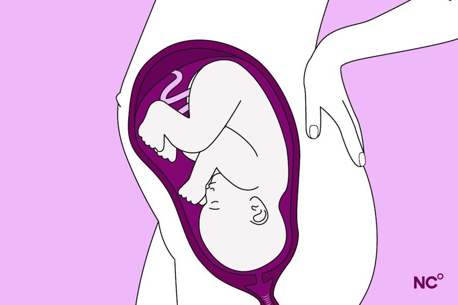 Illustration of a baby in head-down position