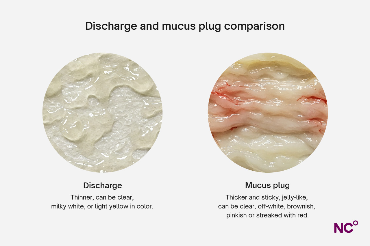 Side by side comparison of discharge and a mucus plug displaying the thicker structure of the mucus plug compared to the thinner discharge