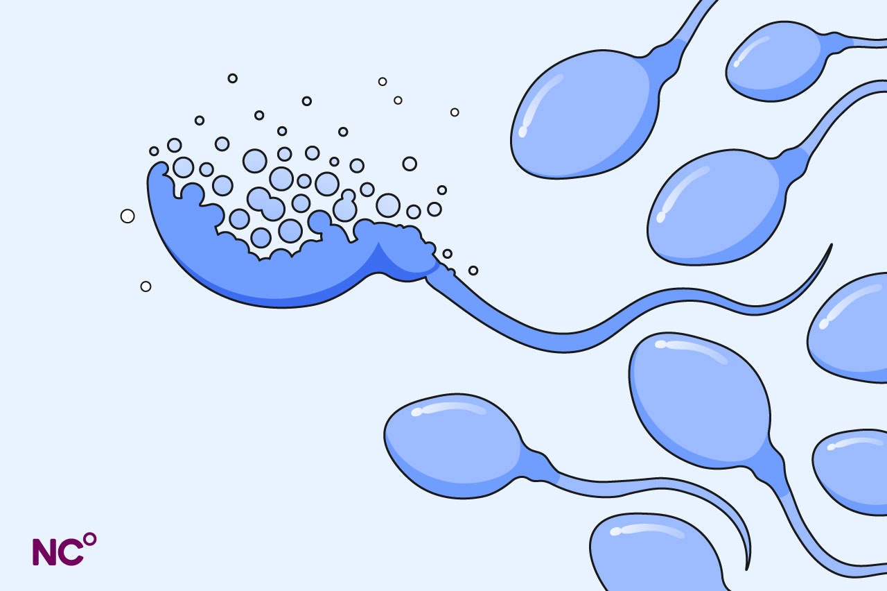 Illustration of sperm swimming on a blue background with one sperm breaking apart