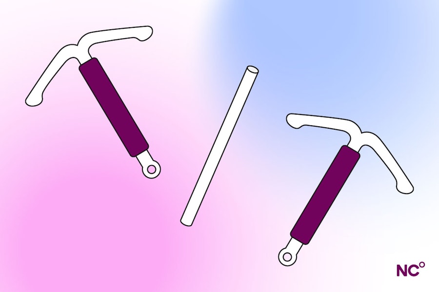 Illustration of two t-shaped IUDs and a rod-shaped implant