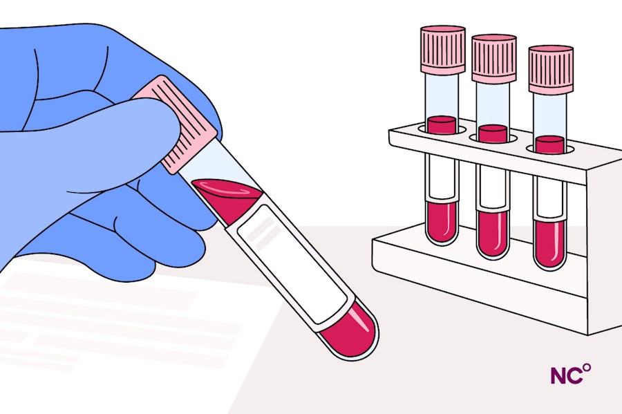 Illustration of four vials of blood with a hand in a blue glove holding one of them