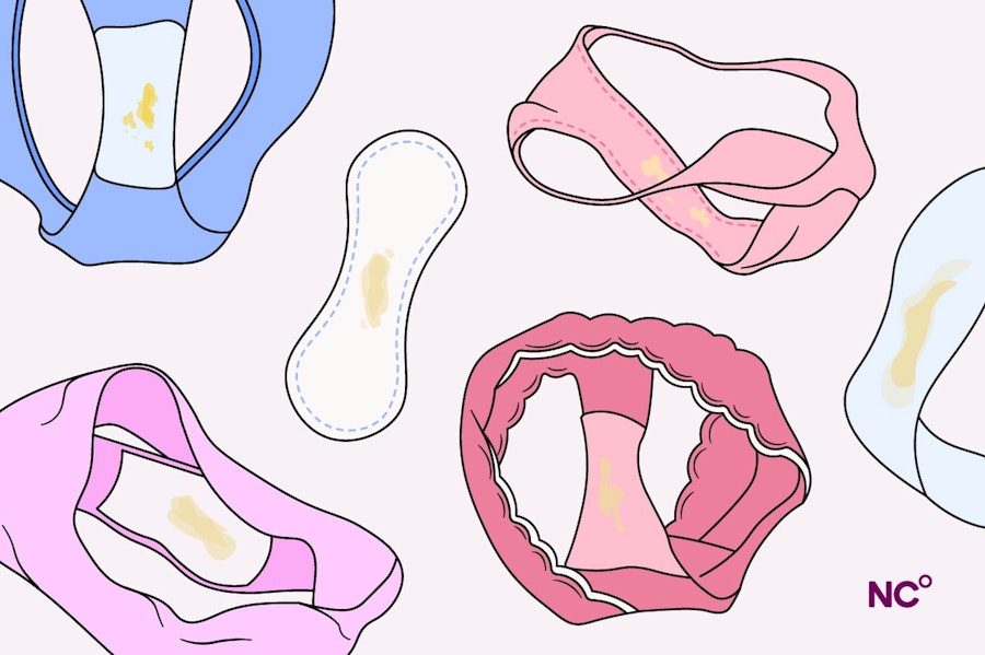 Illustration of different coloured pads and underwear showing yellow discharge