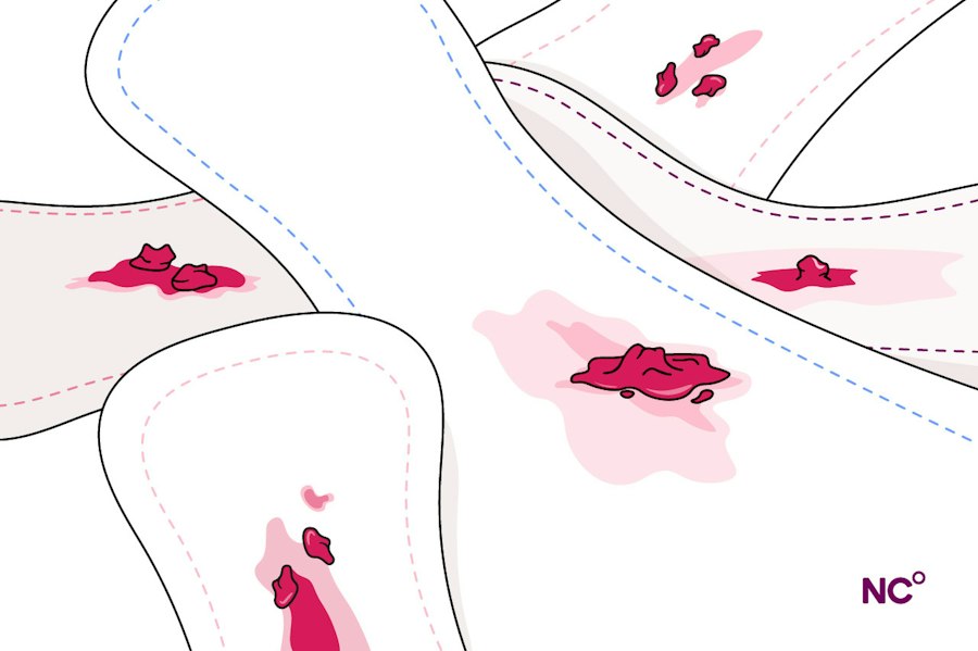Illustration of pads with period blood and blood clots