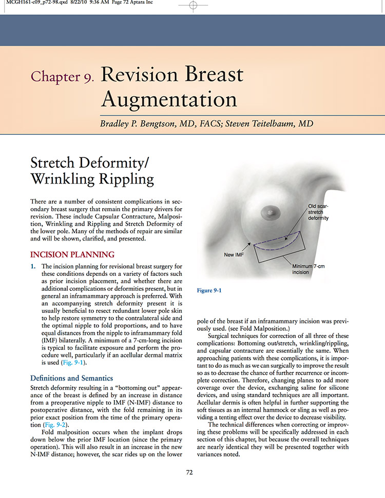 article page