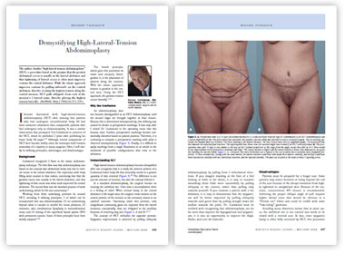Article clipping