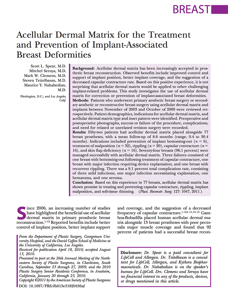 article
