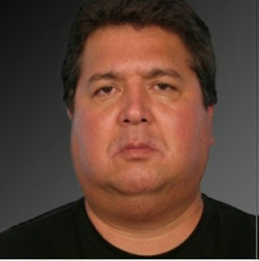 Patient 106038106 | Front View | Before | Men's Face — Steven Teitelbaum MD -