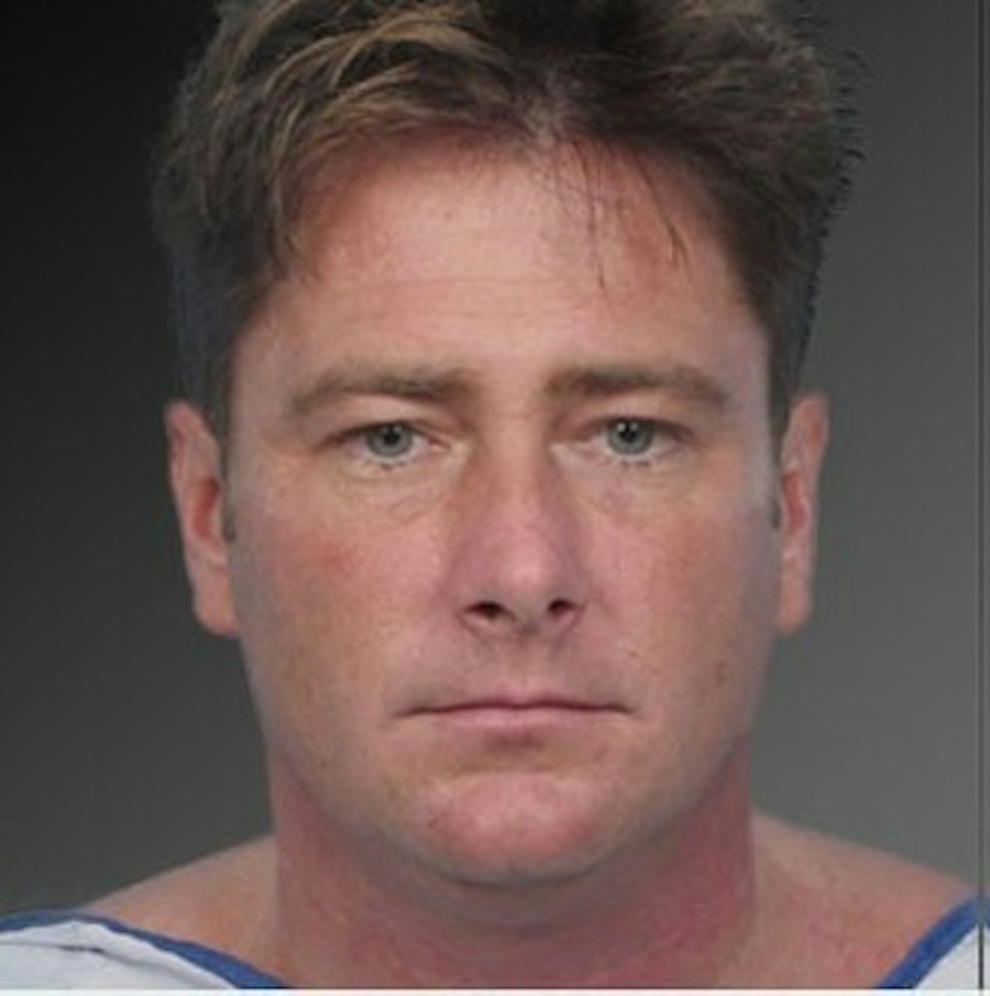 Patient 106041387 | Front View | Before | Neck Liposuction — Steven Teitelbaum MD -