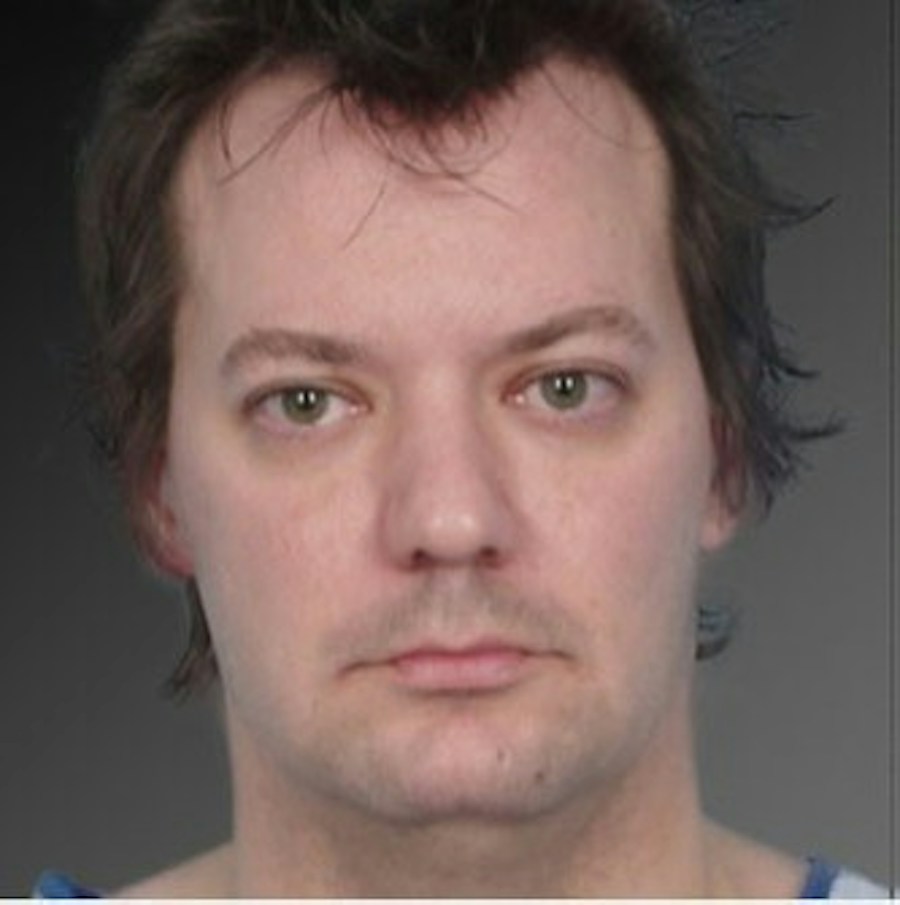 Patient 106041388 | Front View | Before | Neck Liposuction — Steven Teitelbaum MD -