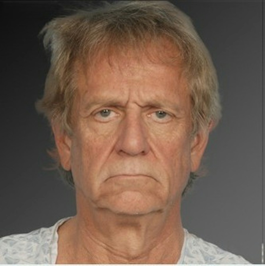 Patient 106041595 | Front View | Before | Men's Face — Steven Teitelbaum MD -