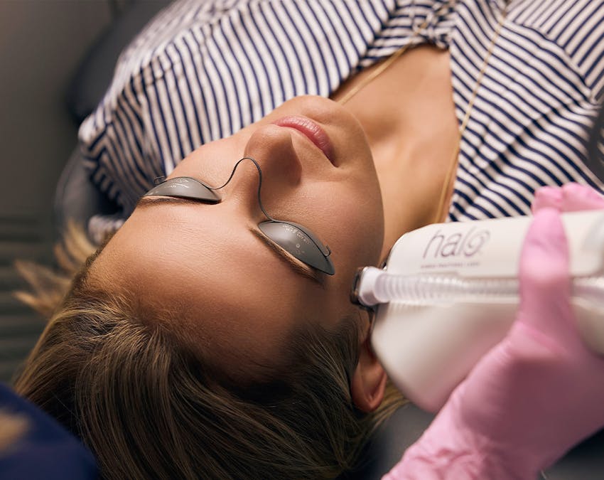 patient undergoing a halo laser treatment