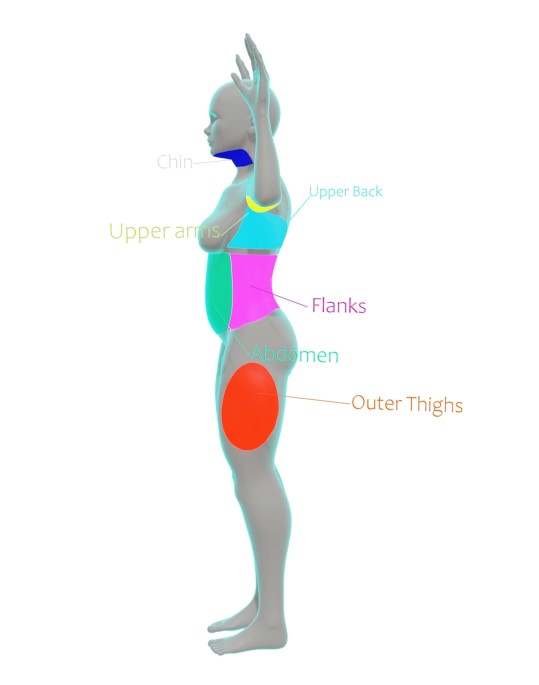 infographic