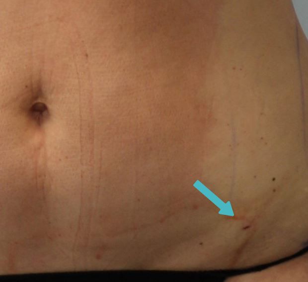 Image of stomach