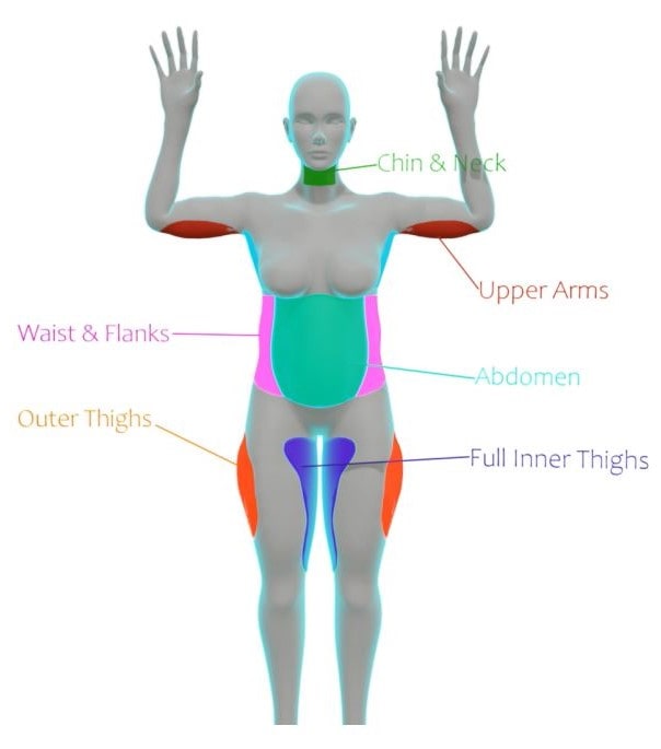 infographic