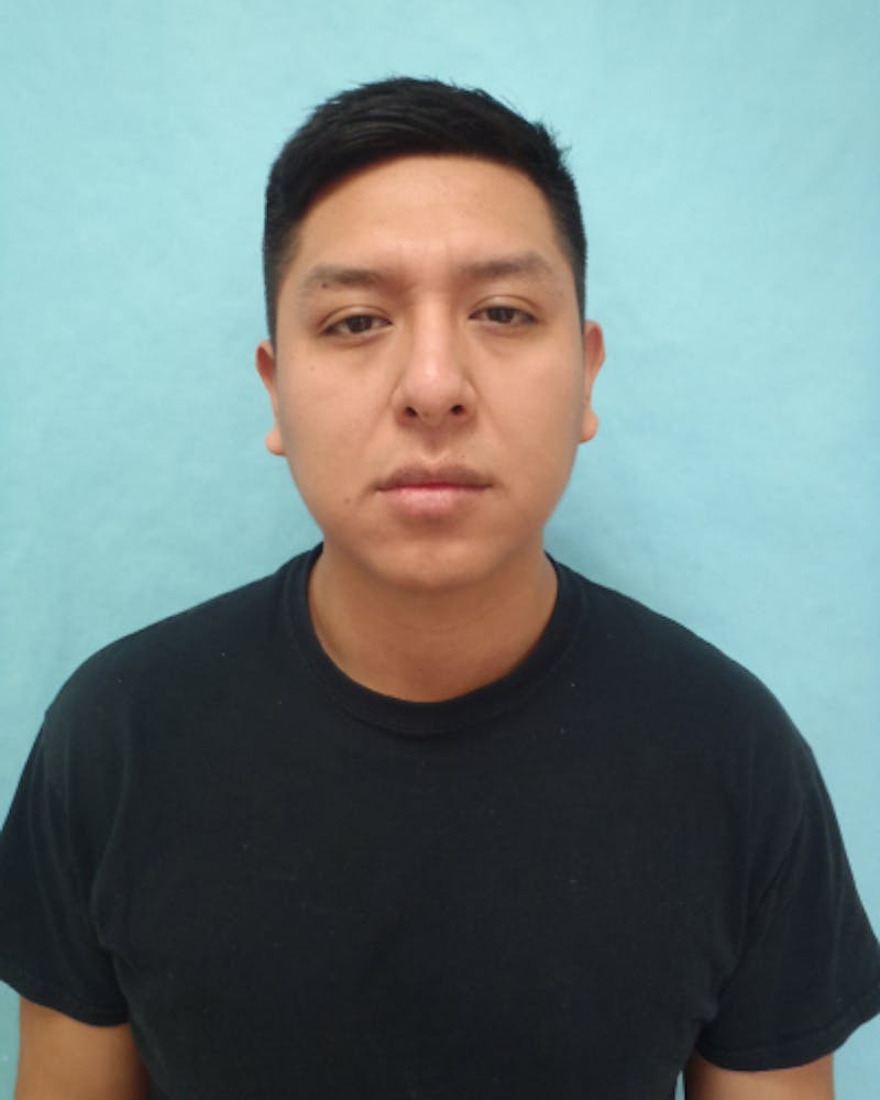 Chin Augmentation Before & After Gallery - Patient 799042 - Image 1